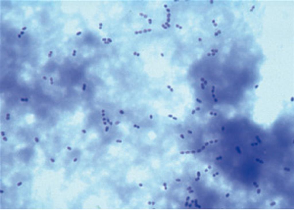 Bakterien als Krankheits- und Seuchenerreger, 25 Präparate