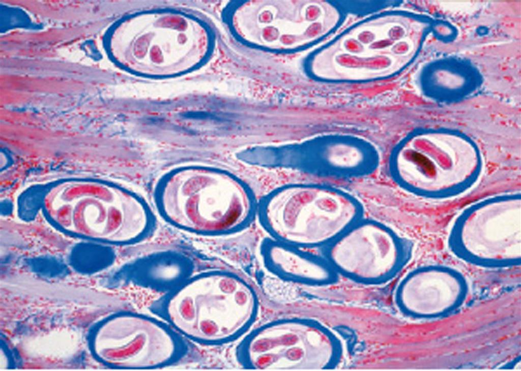 Parasitologie - Große Serie 50 Mikropräparate