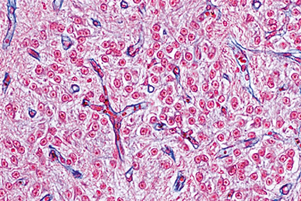 Endokrines System, 6 Präparate 