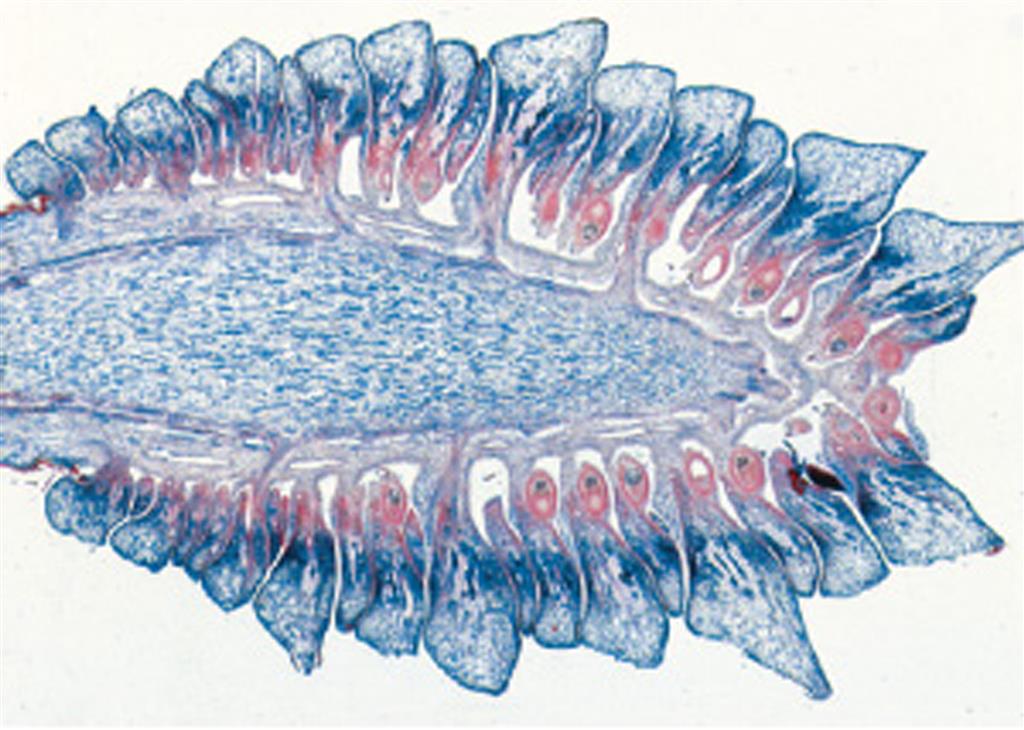 Nacktsamer, Gymnospermae 15 Präparate