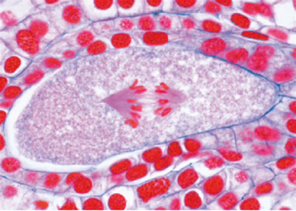 Reifungsteilung in den Pollenmutterzellen der Lilie, 12 Präparate