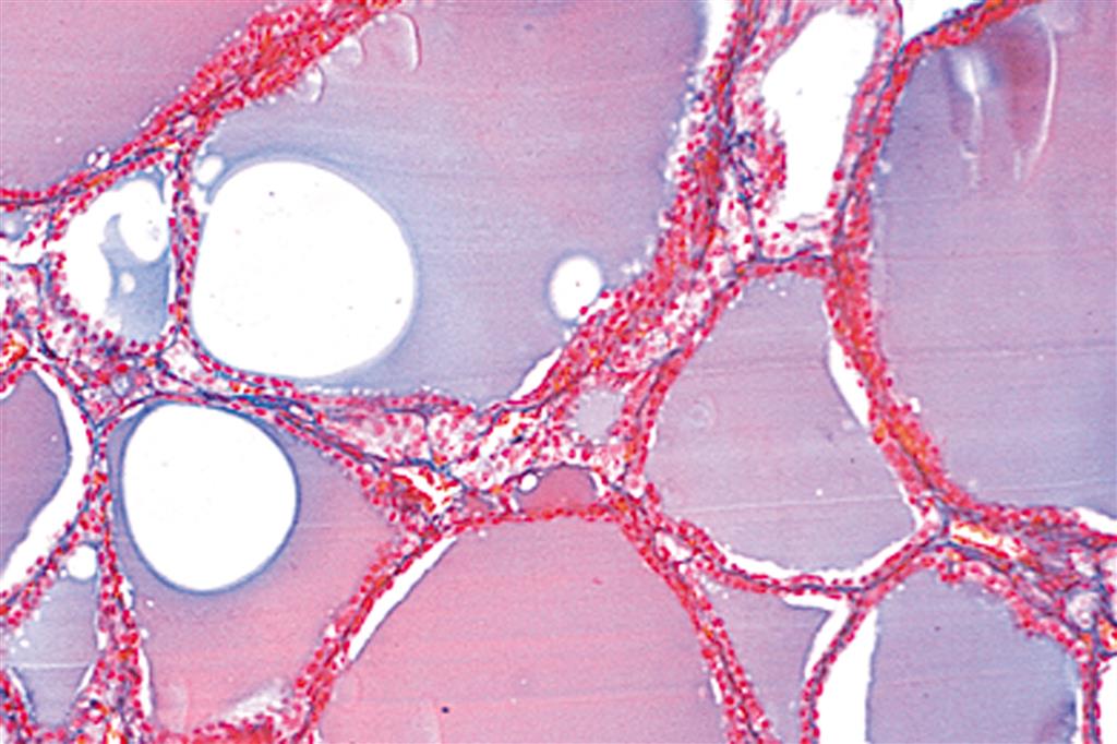 Mikropräparate "Pathologische Histologie des Menschen" 50 Präp.