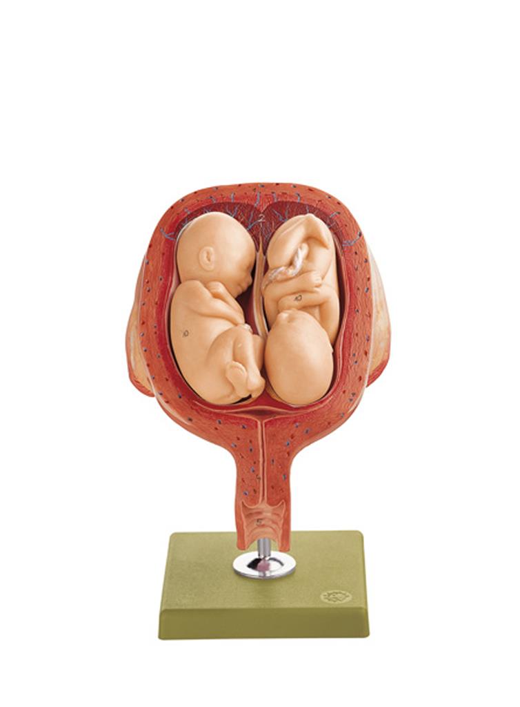 Uterus mit Zwillingsfeten im 5. Monat Einzelmodell aus Schwangerschaftsserie