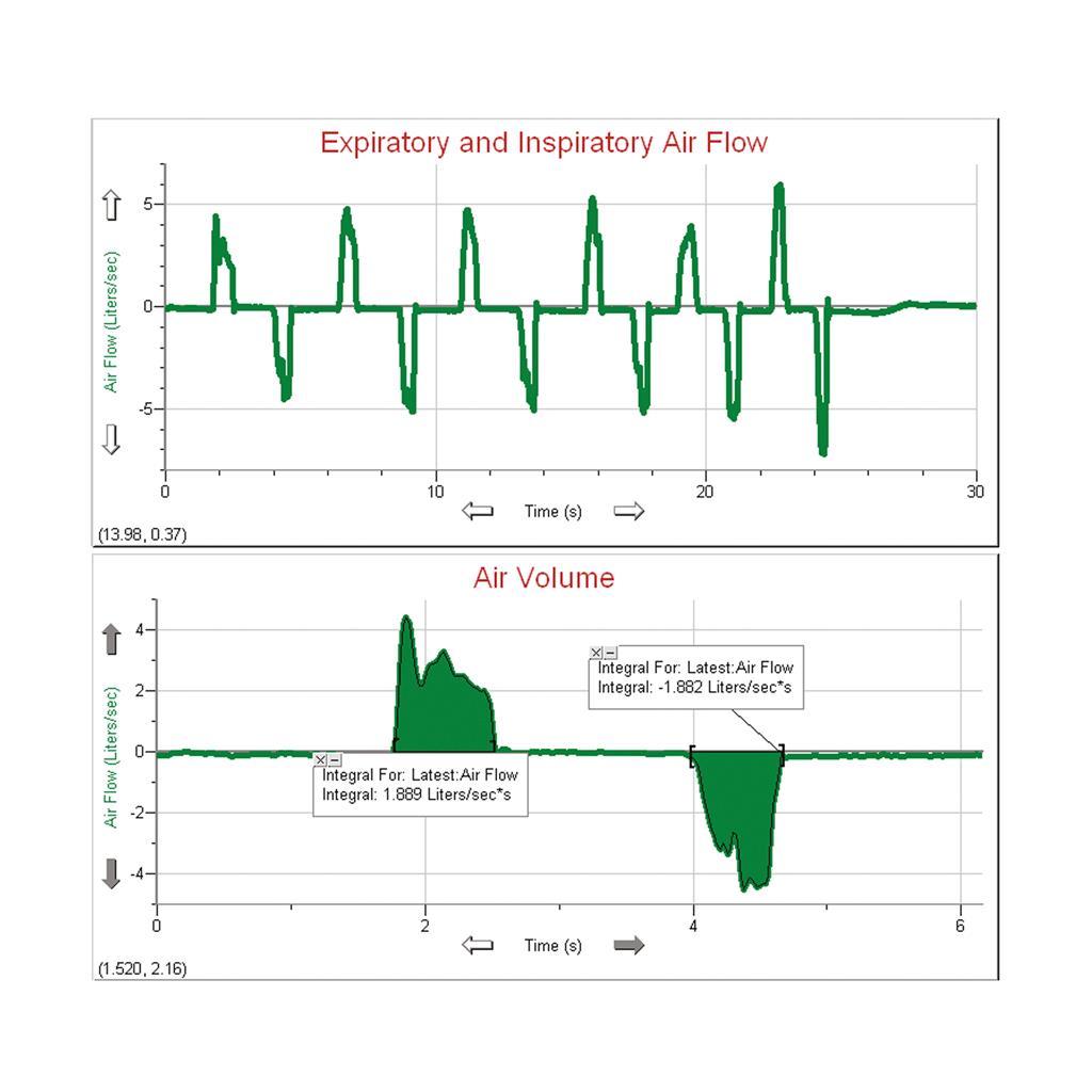 Spirometer 