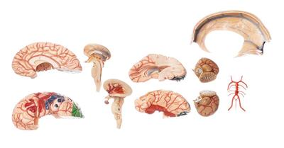 Gehirnmodell, 10-teilig mit Falx cerebri und farblicher Markierung