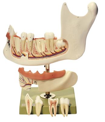 Unterkiefer eines Achtzehnjährigen 3-fach vergrößert, 6-teilig