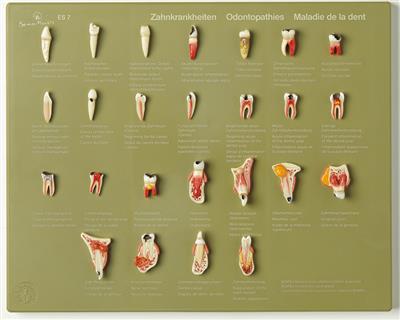 Schaukasten "Zahnkrankheiten" 