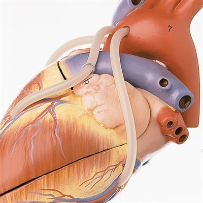 Herzmodell mit Bypassgefäßen 
