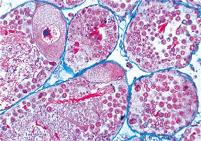 Parasitologie - Große Serie 50 Mikropräparate