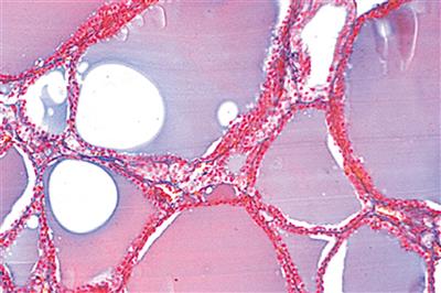 Mikropräparate "Pathologische Histologie des Menschen" 50 Präp.