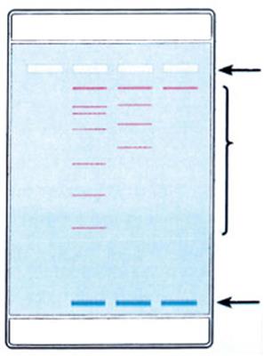 Elektrophorese von DNA 