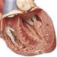 Herz mit Reizleitungssystem (rls) 1,5fach vergrößert, Somso-Plast