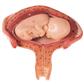 Uterus mit Fetus im 4. bis 5. Monat Einzelmodell aus Schwangerschaftsserie